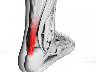 3d rendered illustration of the achilles tendon